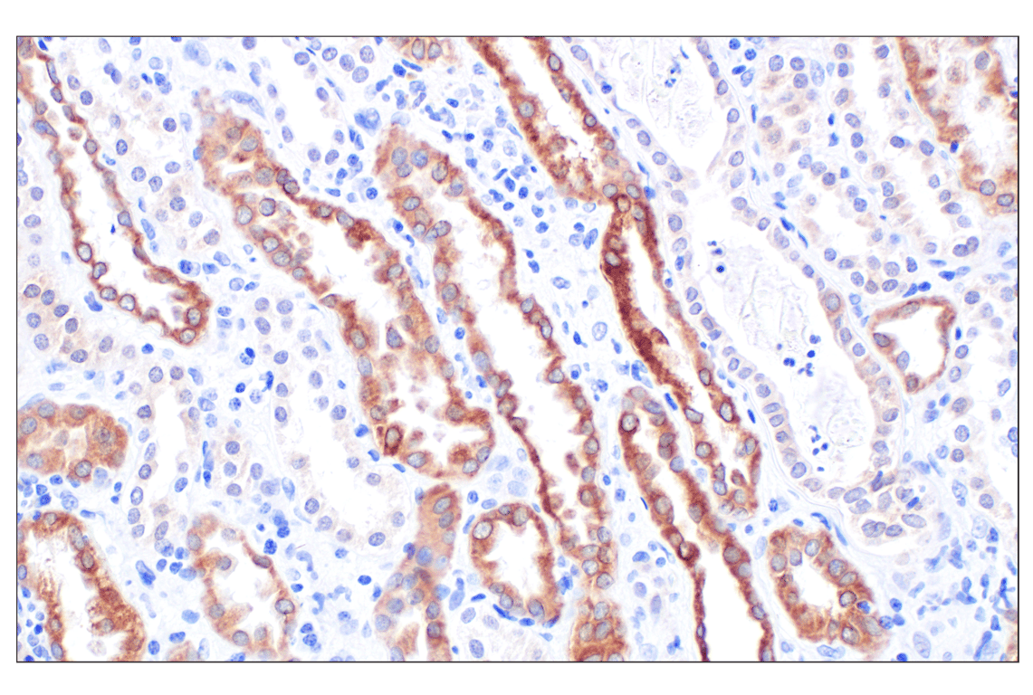 Immunohistochemistry Image 5: MGST1 (F6F5T) Rabbit Monoclonal Antibody