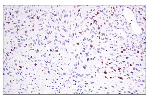 Immunohistochemistry Image 6: ATAD2 (E8Y2K) Rabbit Monoclonal Antibody