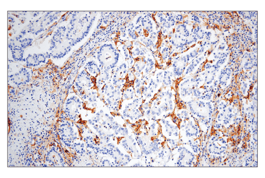Immunohistochemistry Image 1: CD86 (E2G8P) Rabbit Monoclonal Antibody
