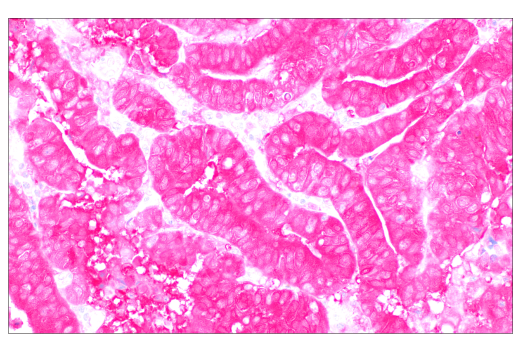 Immunohistochemistry Image 2: SignalStain<sup>®</sup> Boost IHC Detection Reagent (AP, Rat)