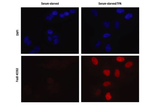 Immunofluorescence Image 1: FosB Antibody