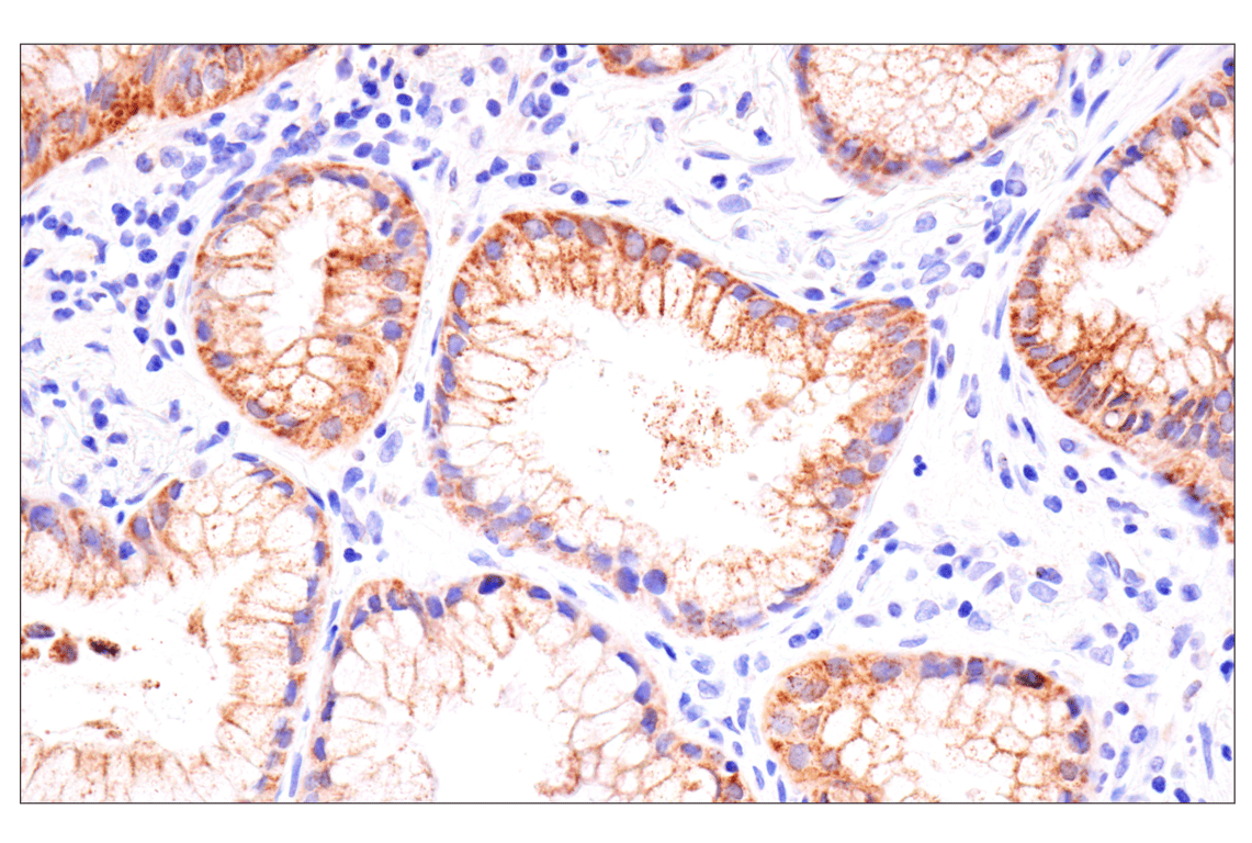 Immunohistochemistry Image 2: AMACR (F7T6V) Rabbit Monoclonal Antibody