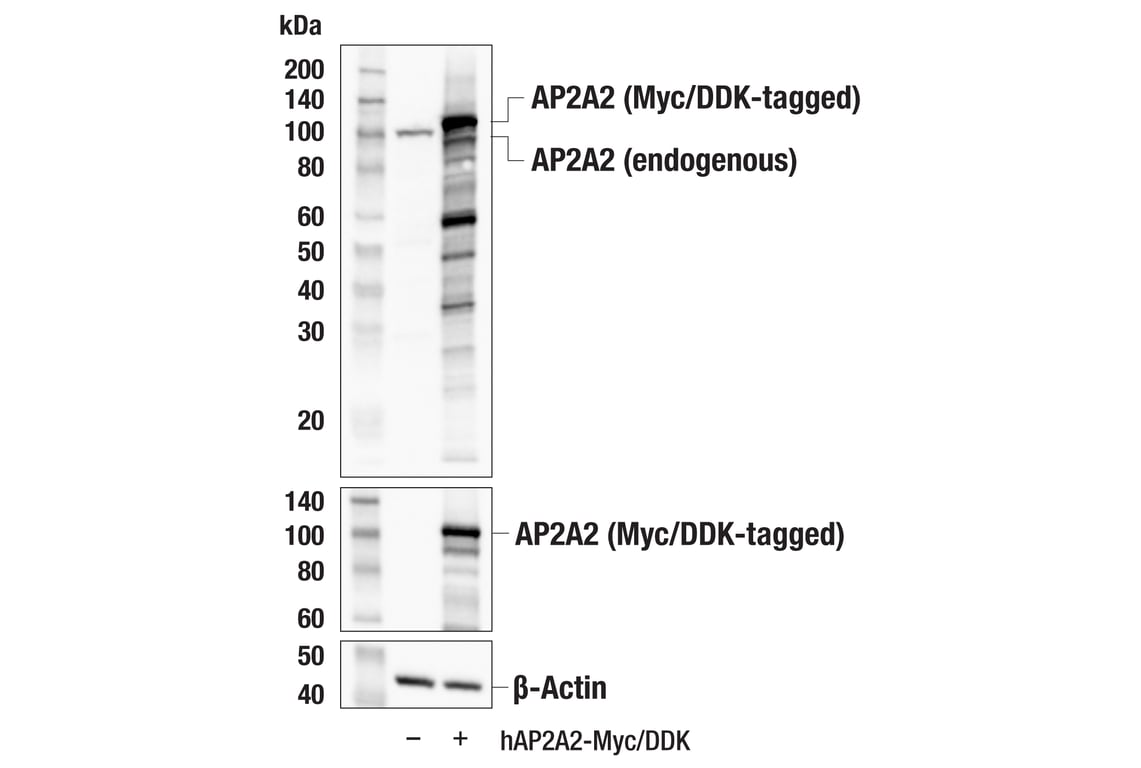 Western Blotting Image 2: AP2A2 (E9Q1O) Rabbit Monoclonal Antibody