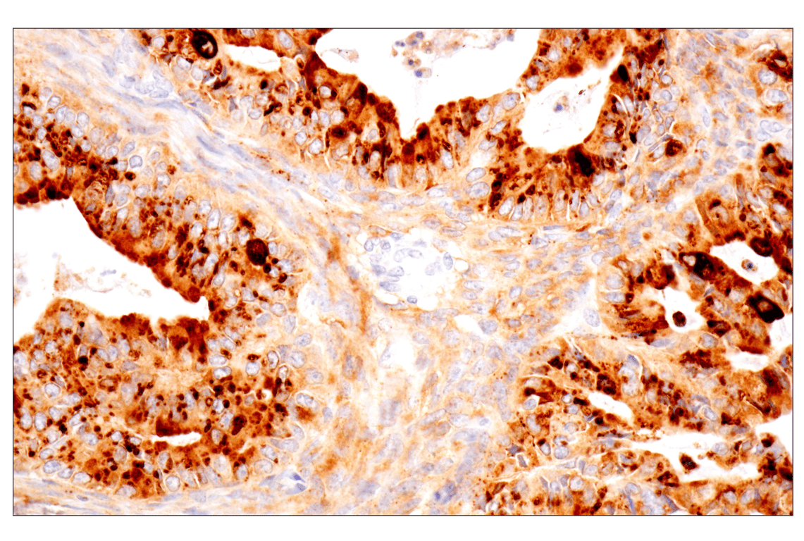 Immunohistochemistry Image 2: MMP-1 (E9S9N) Rabbit Monoclonal Antibody