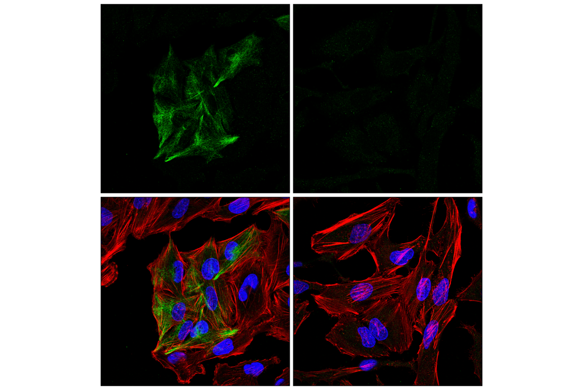 Immunofluorescence Image 1: GFAP (E8S7G) Mouse Monoclonal Antibody