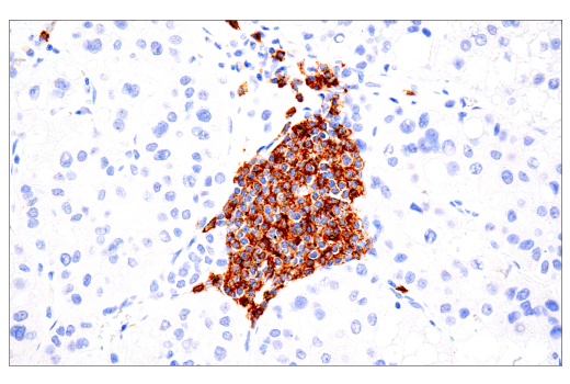 Immunohistochemistry Image 3: CD20 (L26) Mouse Monoclonal Antibody