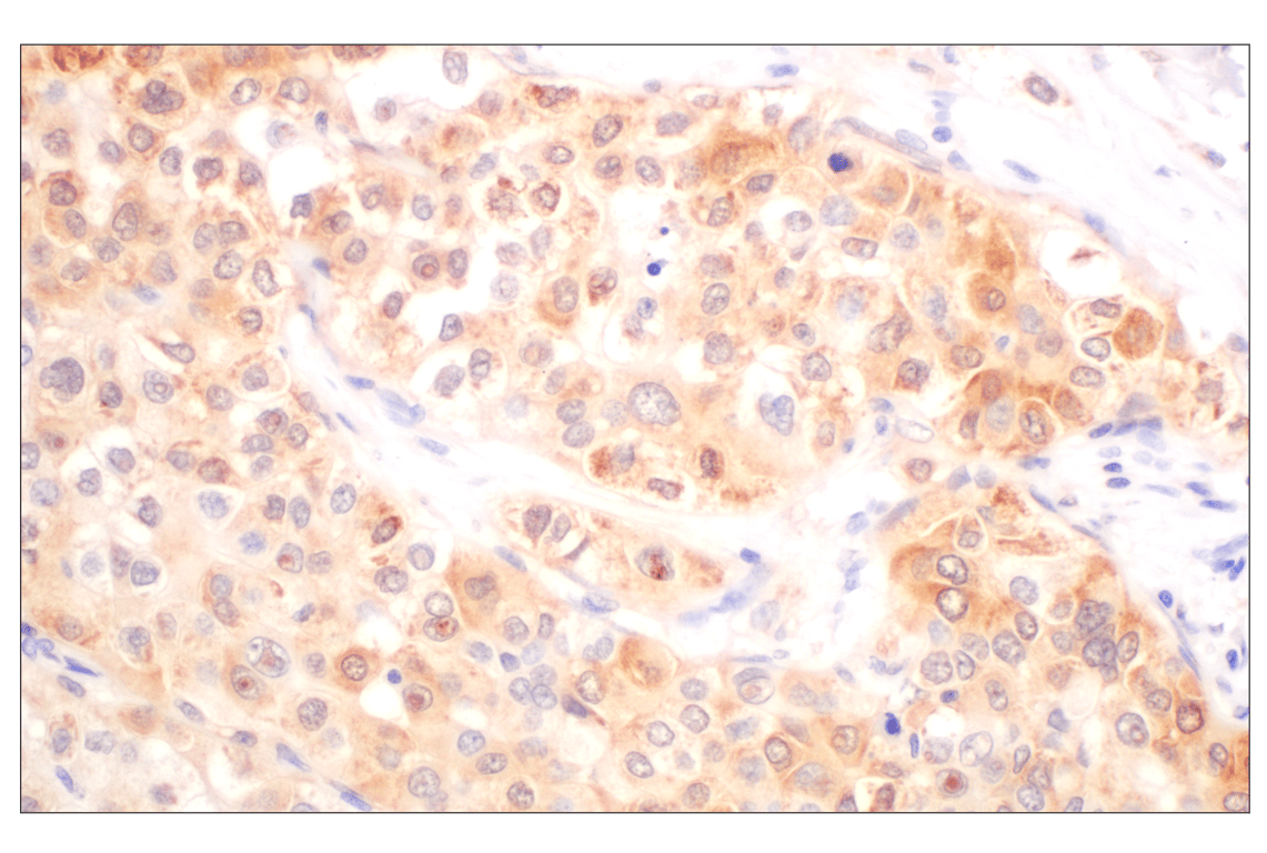 Immunohistochemistry Image 5: Galectin-8/LGALS8 (F9O3T) Rabbit Monoclonal Antibody