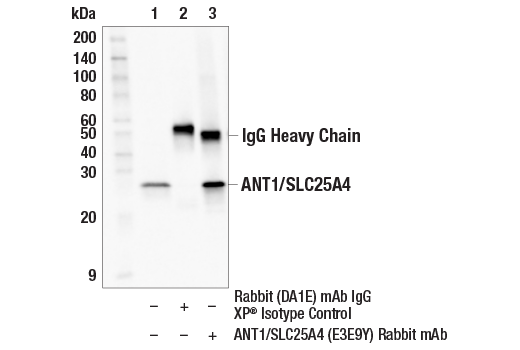 Immunoprecipitation Image 1: ANT1/SLC25A4 (E3E9Y) Rabbit Monoclonal Antibody