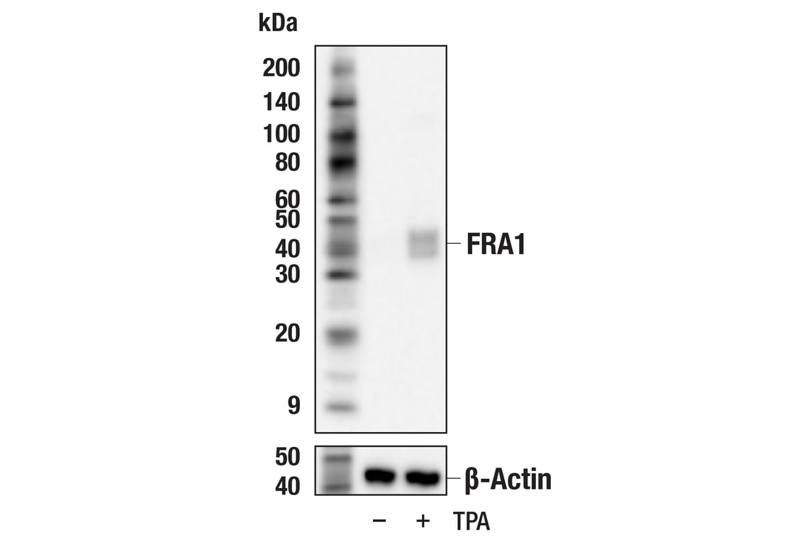 Western Blotting Image 2: FRA1 (F2H9R) Rabbit Monoclonal Antibody
