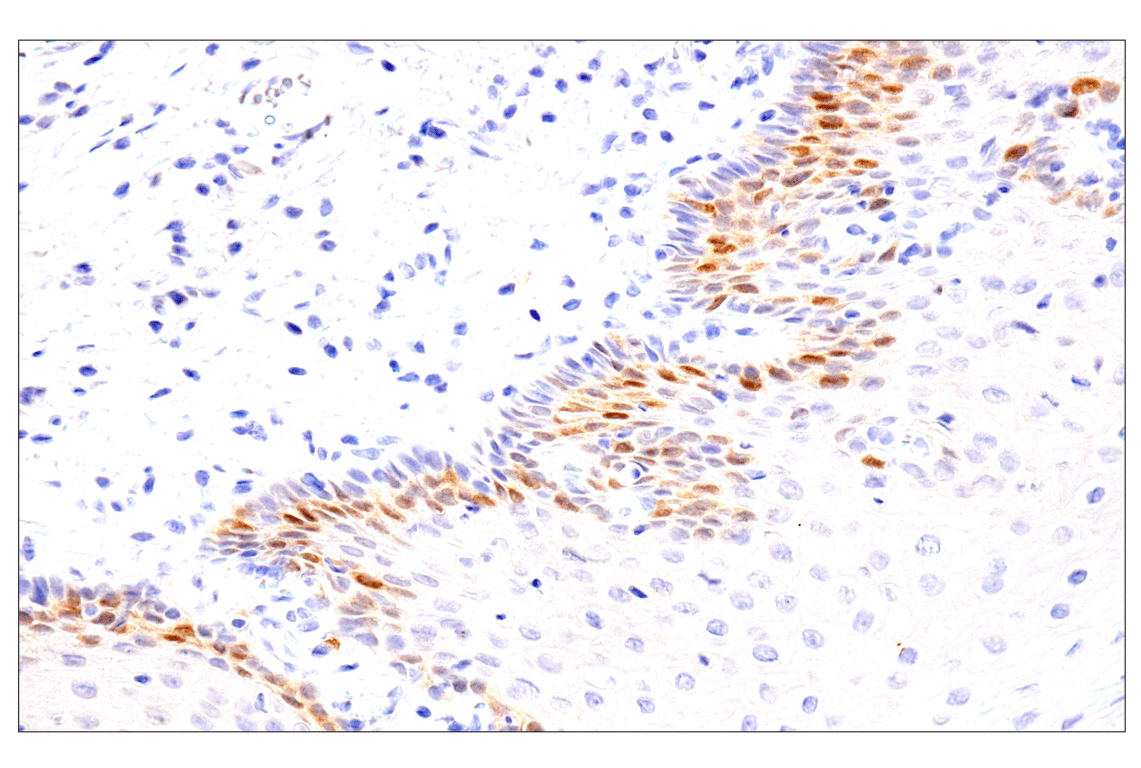 undefined Image 34: Phospho-Chk1/2 Antibody Sampler Kit
