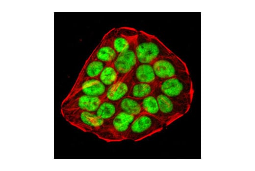 Immunofluorescence Image 1: p53 (1C12) Mouse Monoclonal Antibody