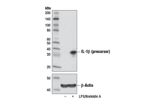 Western Blotting Image 2: IL-1 beta (3A6) Mouse Monoclonal Antibody