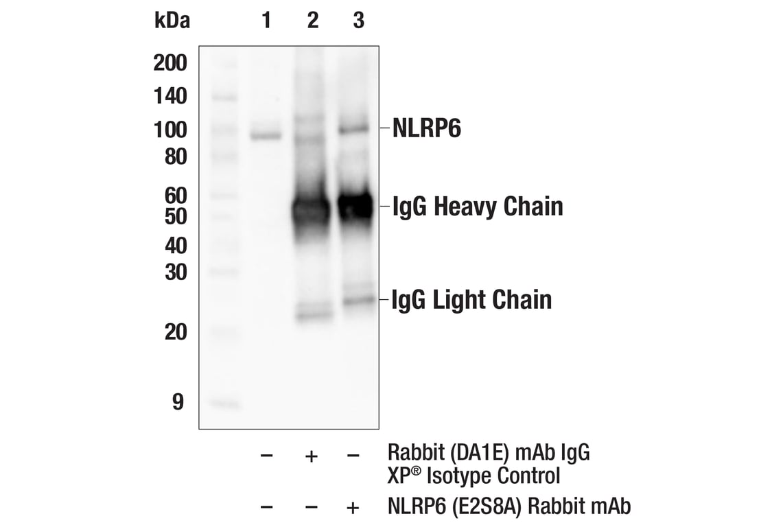 Immunoprecipitation Image 1: NLRP6 (E2S8A) Rabbit Monoclonal Antibody