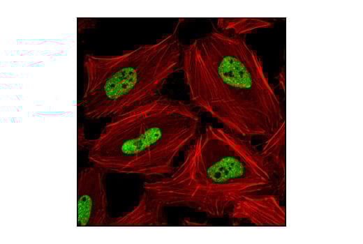 Immunofluorescence Image 1: TDP43 (G400) Antibody