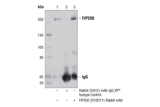 undefined Image 19: Autophagy Induction (ULK1 Complex) Antibody Sampler Kit