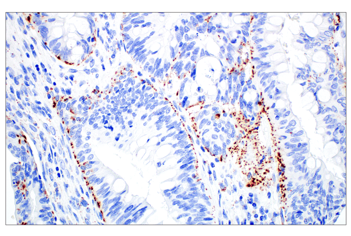 Immunohistochemistry Image 5: Perilipin-2 (E6G6M) Rabbit Monoclonal Antibody