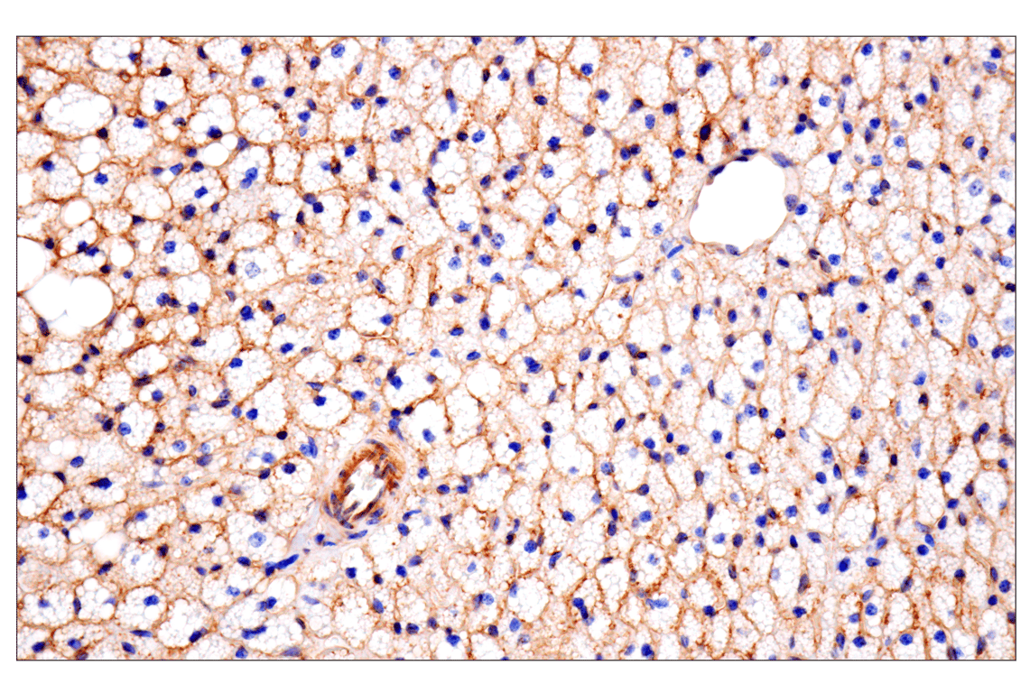Immunohistochemistry Image 6: CD81 (D5O2Q) Rabbit Monoclonal Antibody (BSA and Azide Free)