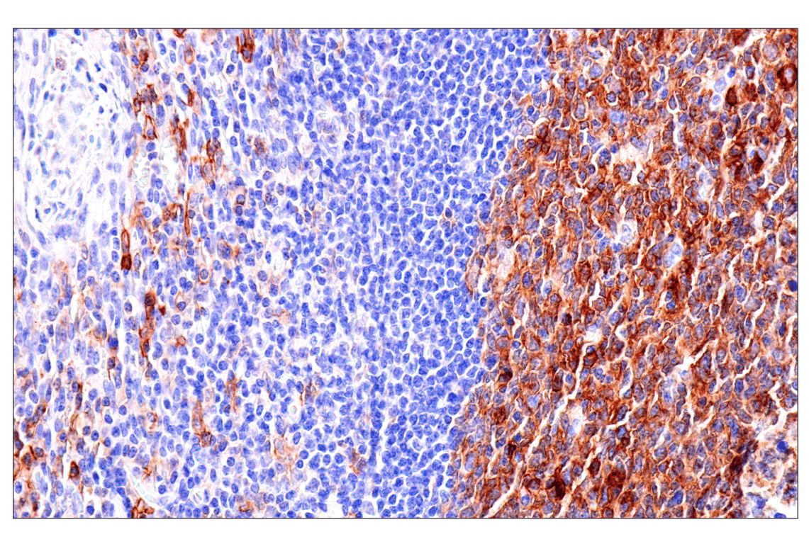Immunohistochemistry Image 7: Semaphorin-4A (E5N3K) Rabbit Monoclonal Antibody (BSA and Azide Free)