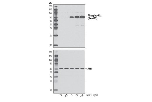 undefined Image 3: Human Insulin-like Growth Factor I (hIGF-I)