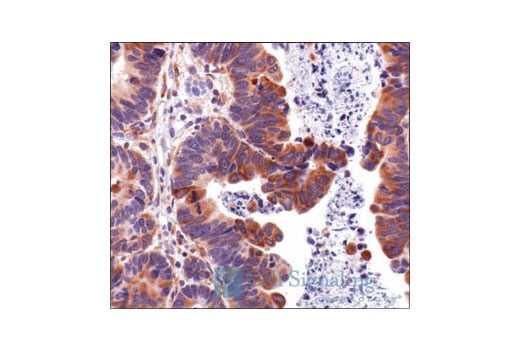 Immunohistochemistry Image 4: Phospho-S6 Ribosomal Protein (Ser235/236) Antibody