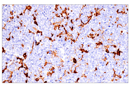 Immunohistochemistry Image 8: FcR gamma (E6Y1A) Rabbit Monoclonal Antibody