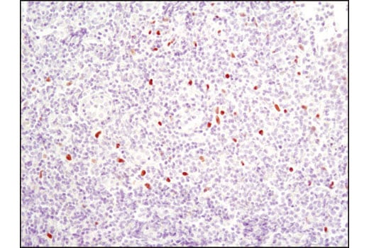 Immunohistochemistry Image 4: C/EBPα (D56F10) XP<sup>®</sup> Rabbit mAb