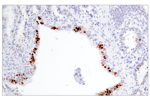 Immunohistochemistry Image 2: BCL6 (E5I8I) Rabbit Monoclonal Antibody (BSA and Azide Free)