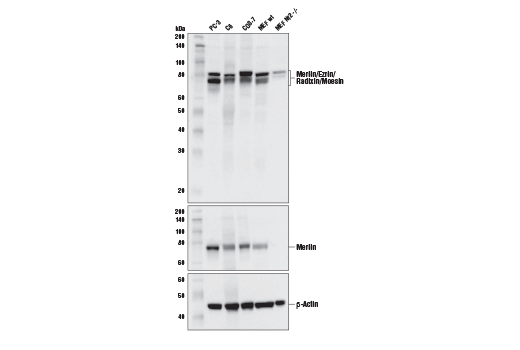 Western Blotting Image 1: Merlin/Ezrin/Radixin/Moesin (D1P8I) Rabbit mAb