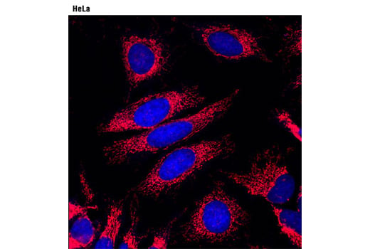 Immunofluorescence Image 1: Anti-rabbit IgG (H+L), F(ab')<sub>2</sub> Fragment (Alexa Fluor<sup>®</sup> 594 Conjugate)