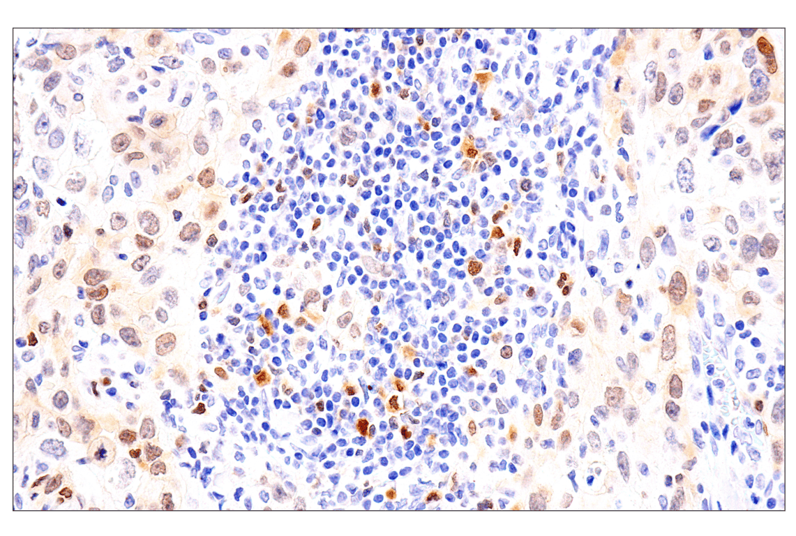 Immunohistochemistry Image 1: Chk1 (2G1D5) Mouse mAb