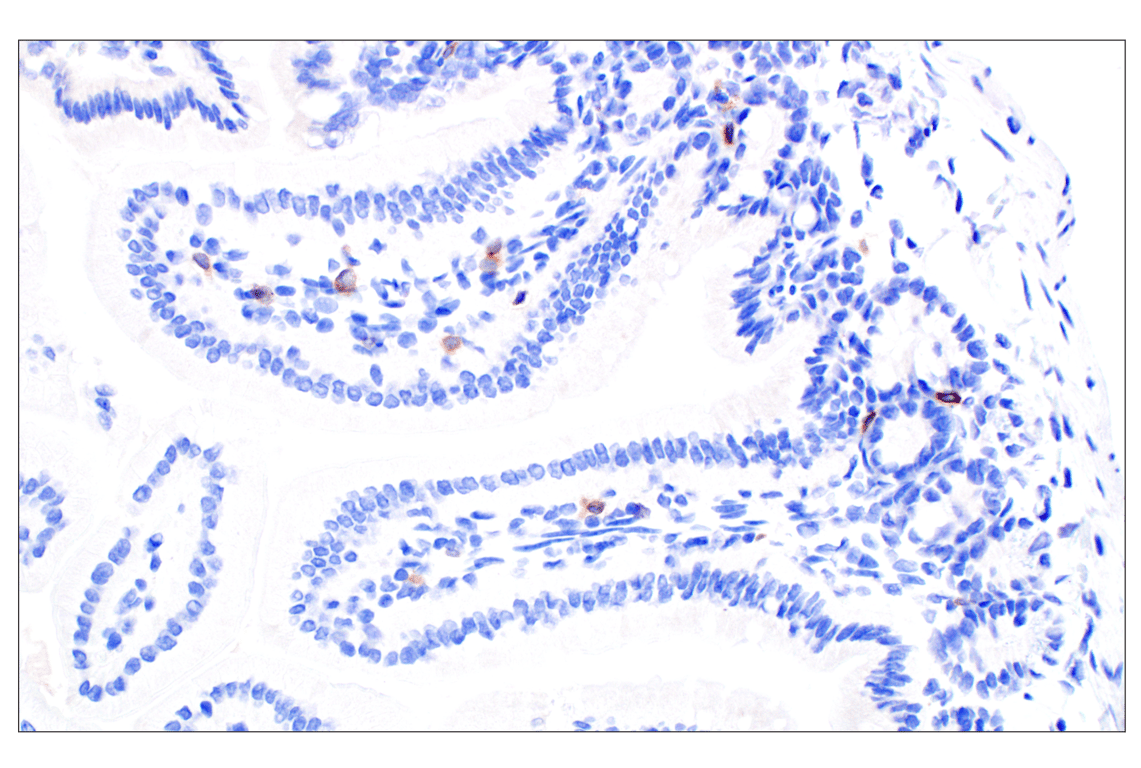 Immunohistochemistry Image 7: NCR1/NKp46 (F8M2L) Rabbit Monoclonal Antibody (IHC Formulated)