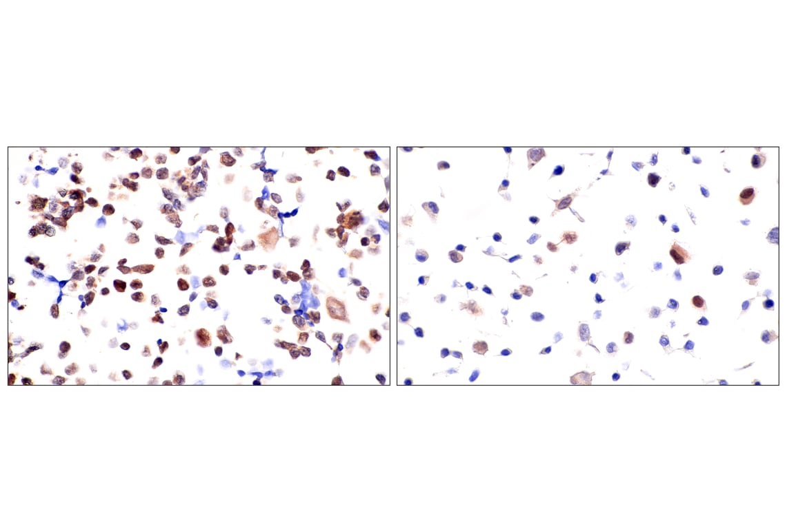 Immunohistochemistry Image 14: Chk1 (2G1D5) Mouse Monoclonal Antibody (BSA and Azide Free)
