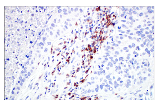Immunohistochemistry Image 4: TIGIT (E5Y1W) Rabbit Monoclonal Antibody (BSA and Azide Free)