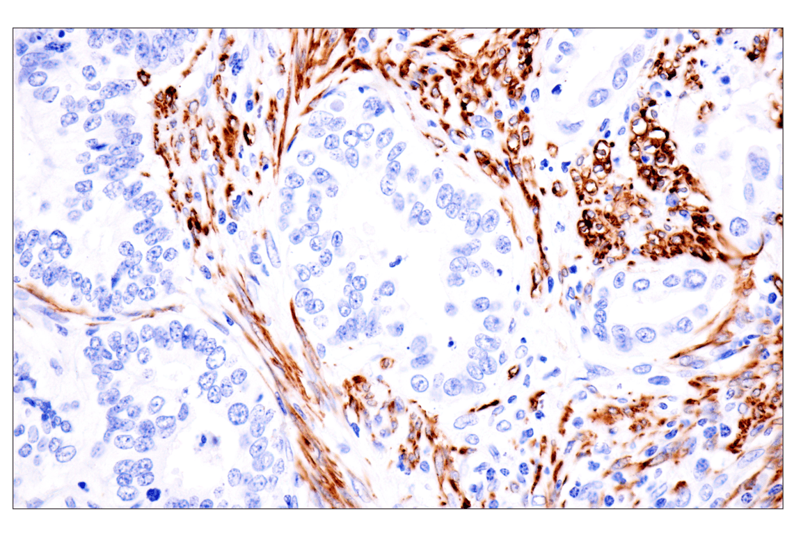 Immunohistochemistry Image 5: Desmin (F5V4I) Rabbit Monoclonal Antibody (BSA and Azide Free)