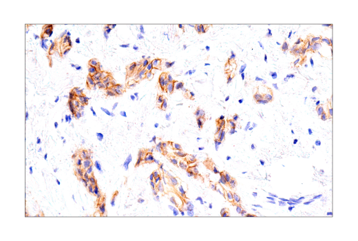 Immunohistochemistry Image 2: HER2/ErbB2 (D8F12) Rabbit Monoclonal Antibody
