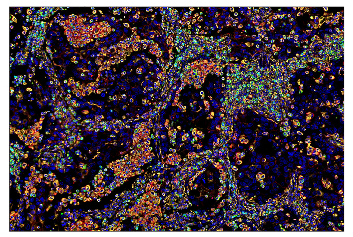 Immunohistochemistry Image 7: TIM-3 (D5D5R) & CO-00010-488 SignalStar<sup>®</sup> Oligo-Antibody Pair