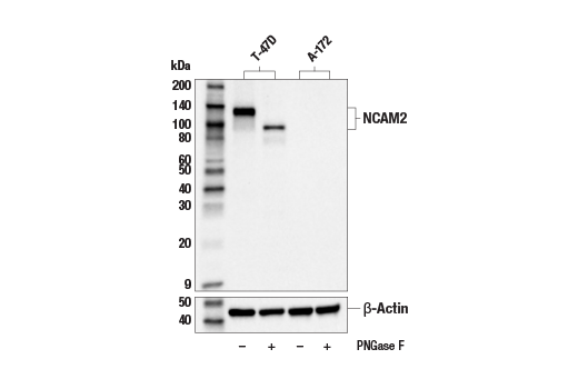 Western Blotting Image 2: NCAM2 (E8J3B) Rabbit Monoclonal Antibody