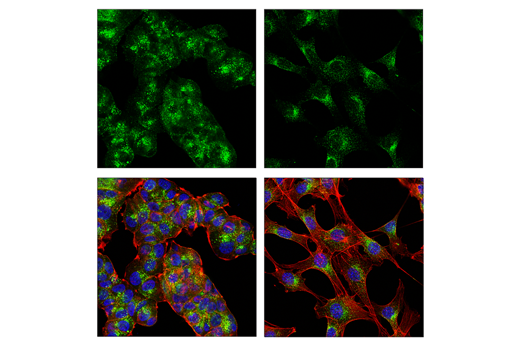 Immunofluorescence Image 1: EEA1 (E9Q6G) Mouse Monoclonal Antibody