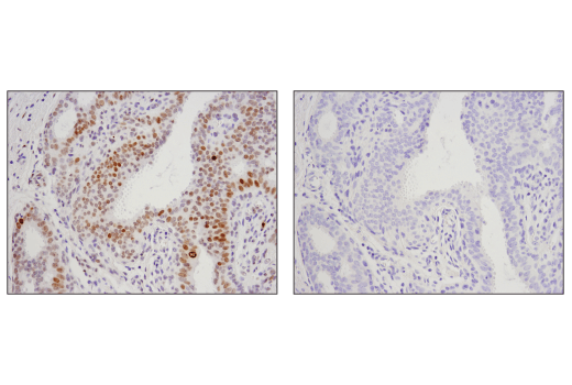 Immunohistochemistry Image 5: Phospho-Histone H2A.X (Ser139) (D7T2V) Mouse Monoclonal Antibody
