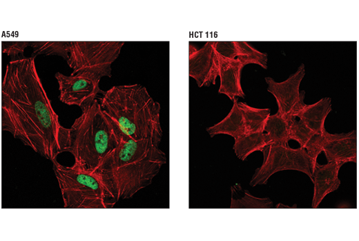 Immunofluorescence Image 1: MLL2/KMT2B (D6X2E) Rabbit Monoclonal Antibody (Carboxy-terminal Antigen)
