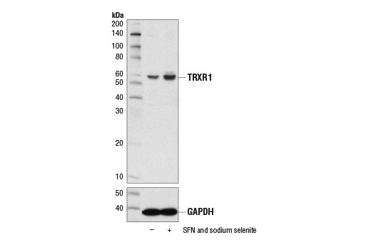 Western Blotting Image 2: TRXR1 (D1T3D) Rabbit Monoclonal Antibody