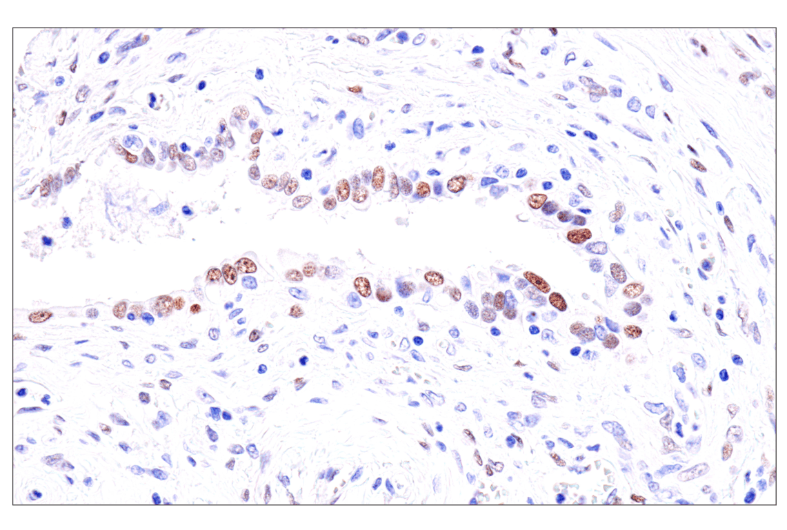 Immunohistochemistry Image 4: GATA-6 (D61E4) Rabbit Monoclonal Antibody (BSA and Azide Free)
