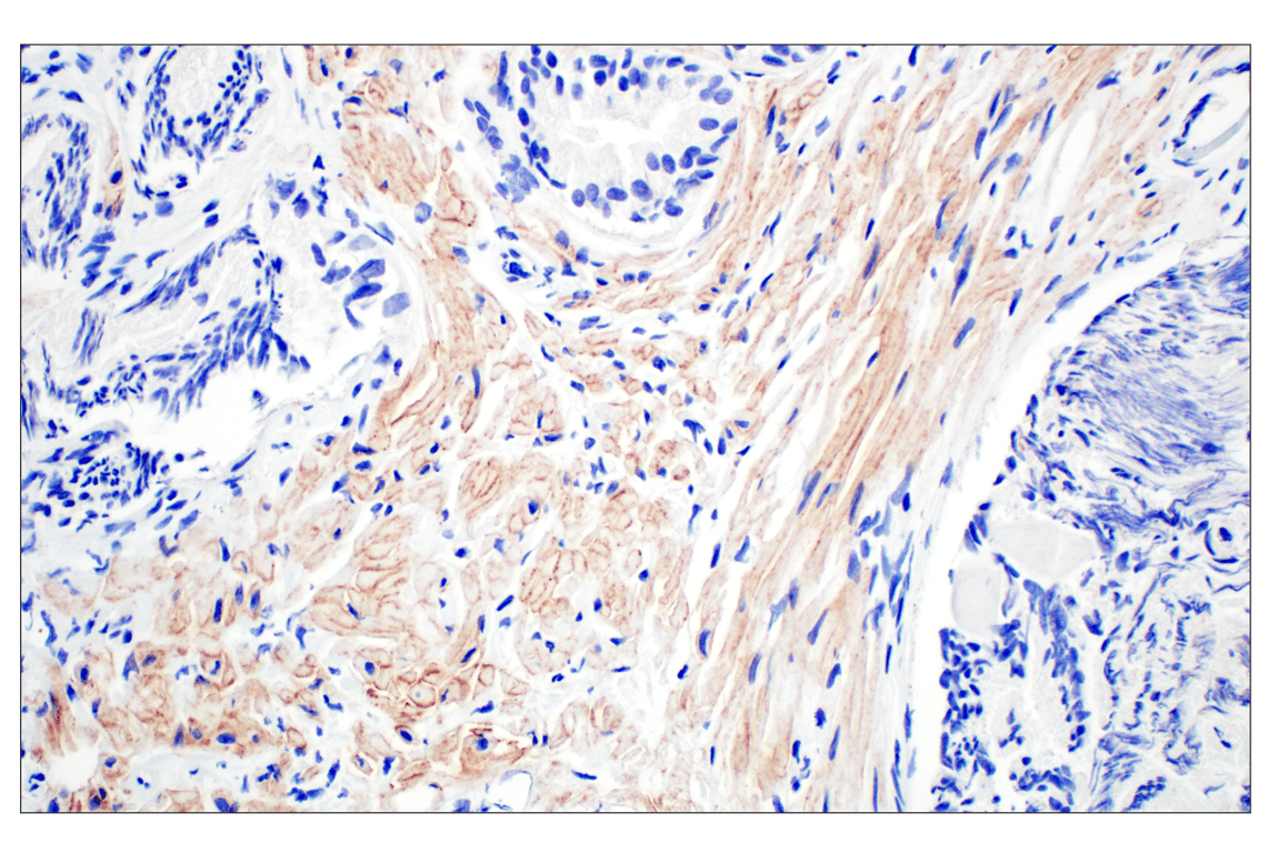 Immunohistochemistry Image 5: Dystrophin (E4F3S) Rabbit Monoclonal Antibody