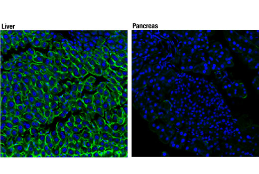 Immunofluorescence Image 1: EGF Receptor (D1P9C) Rabbit Monoclonal Antibody