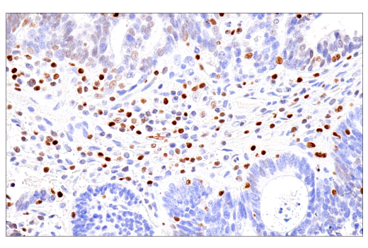 Immunohistochemistry Image 4: RUNX3/AML2 (E8D5W) Rabbit Monoclonal Antibody
