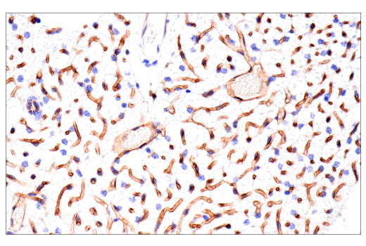 Immunohistochemistry Image 10: CD38 (E9F5A) Rabbit Monoclonal Antibody