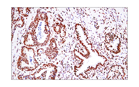 Immunohistochemistry Image 5: 53BP1 (E7N5D) Rabbit Monoclonal Antibody (BSA and Azide Free)