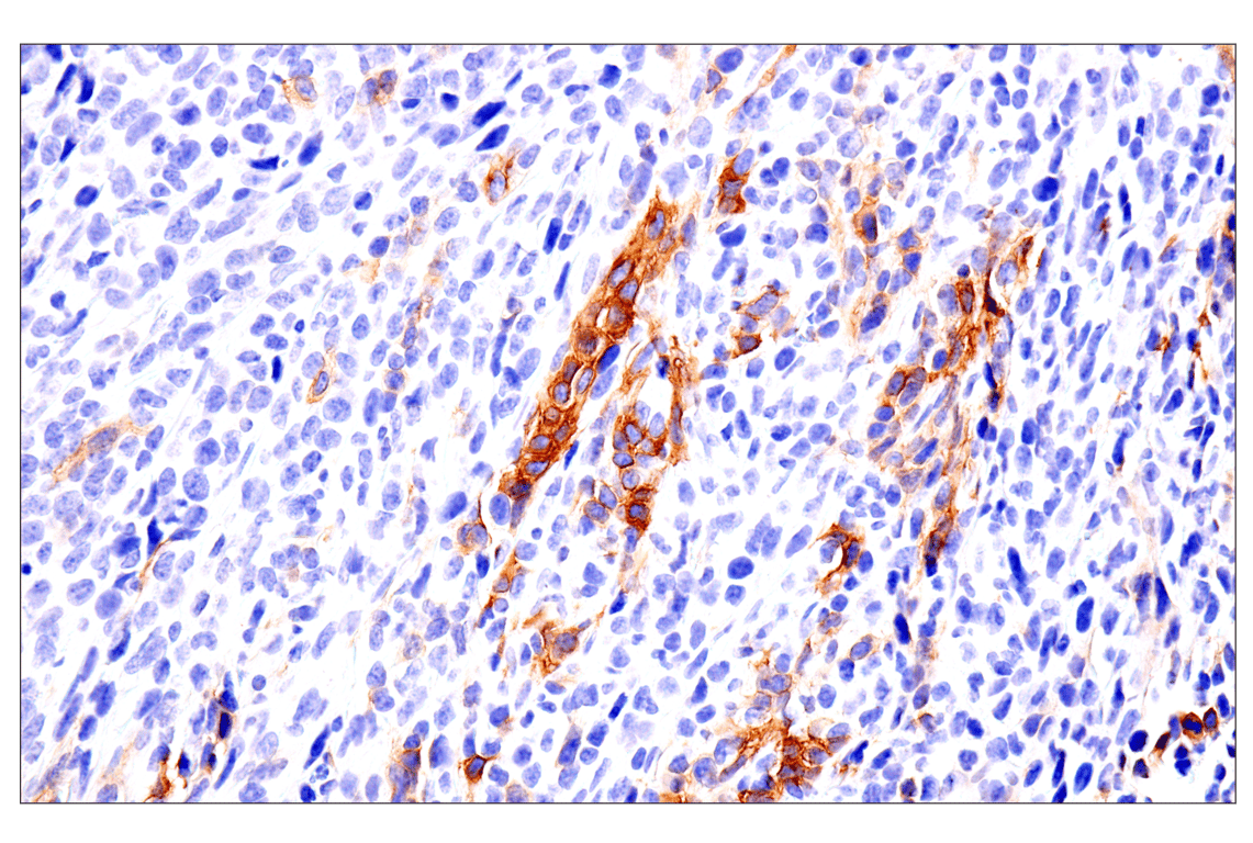 Immunohistochemistry Image 14: p75NTR (E7I3M) Rabbit Monoclonal Antibody (BSA and Azide Free)