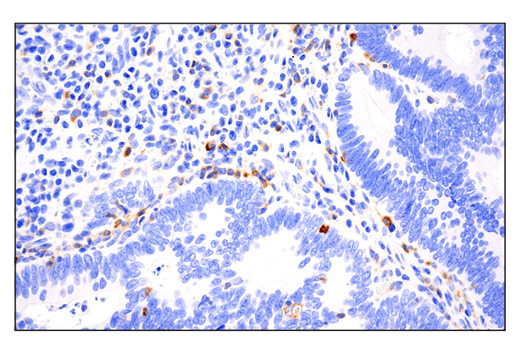 Immunohistochemistry Image 2: Phospho-SLP-76 (Ser376) (E3G9U) Rabbit Monoclonal Antibody (BSA and Azide Free)