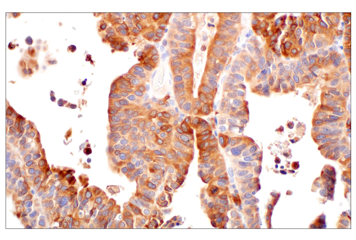 Immunohistochemistry Image 2: HO-1 (E8B7A) XP<sup>®</sup> Rabbit mAb